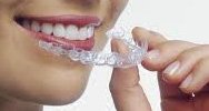 Invisalign Platinum Provider in Alexandria VA