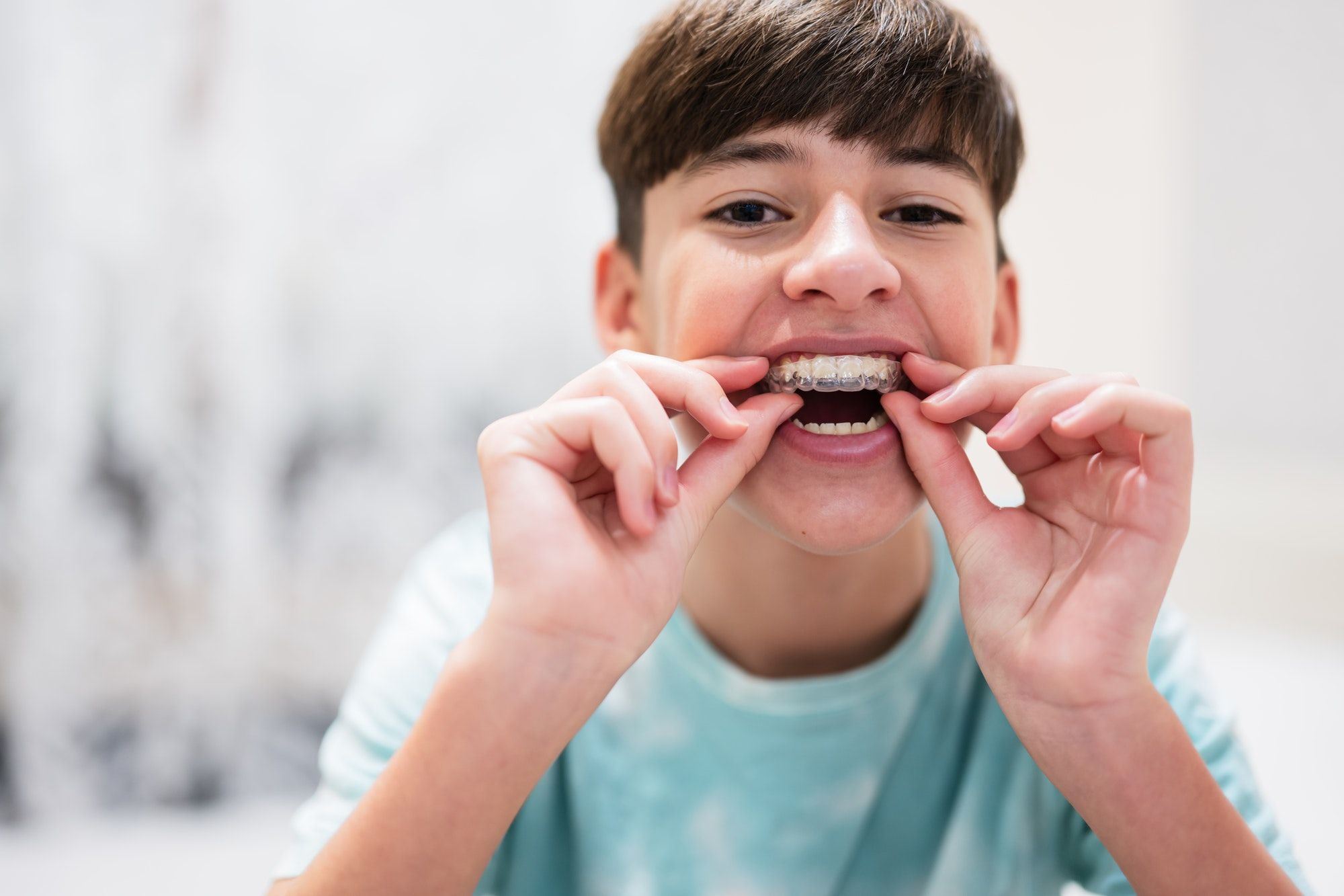 Teen boy putting on clear aligners, how to clean Invisalign, First Impression Orthodontics in Alexandria, VA