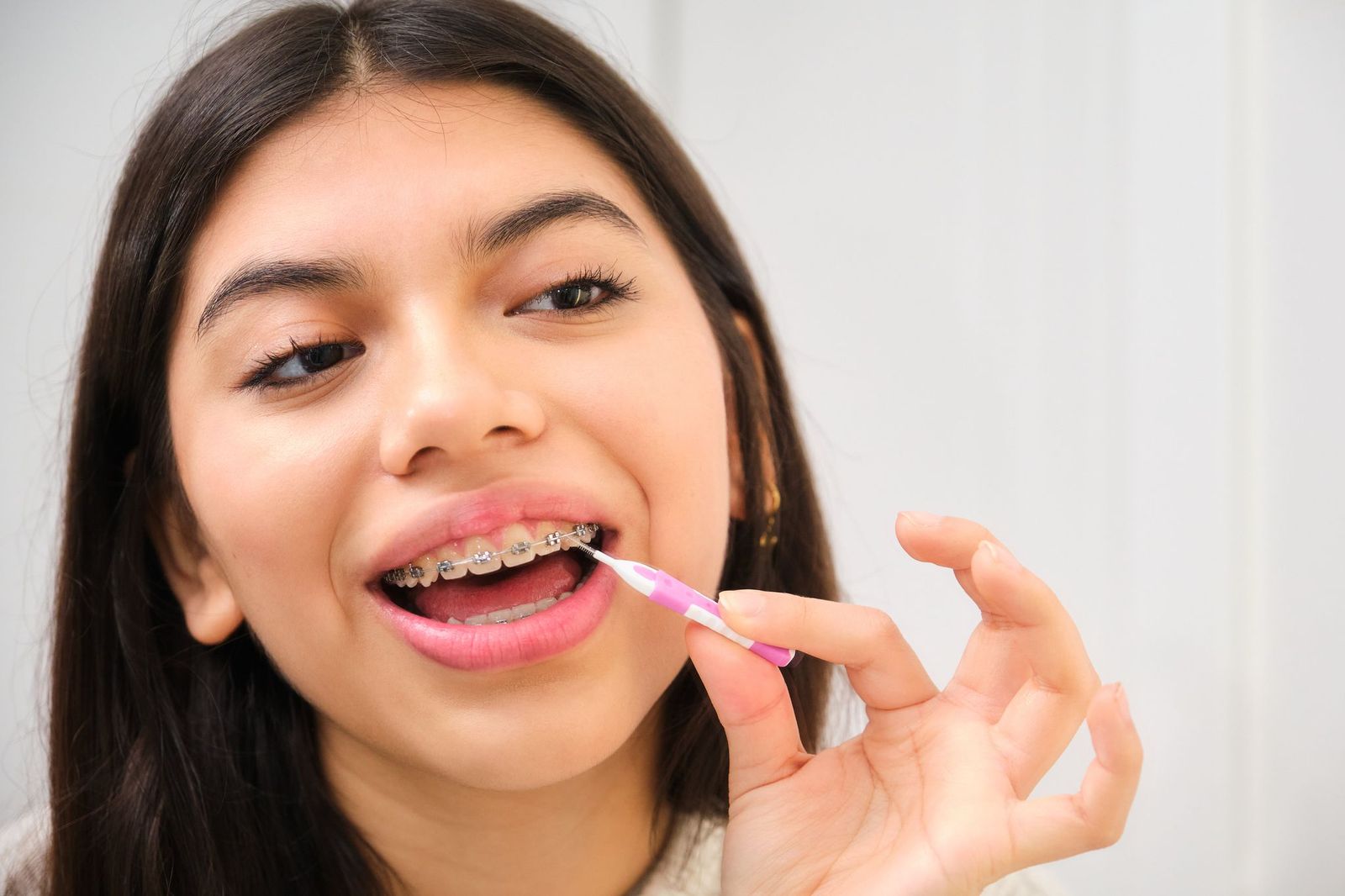 Can You Get Braces With Cavities? Everything You Need to Know